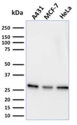 Myofibroblast Marker Antibody (PR 2D3) - Azide and BSA Free, Novus Biologicals
